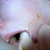 vomit out my own shit elecebra