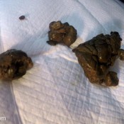 these poops hurt my butthole! ouch! loverachelle2