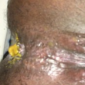 shit bomb hd ebonyscatbbw