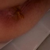 shit ass and mucus pussy hotdirtyivone