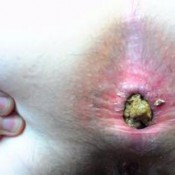 mud pie 2 kalasextoncb