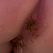 Freckled_feet A Soft One Freckled Feet