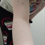 Autumnbottum Smelly Ass Shit Autumn Bottum